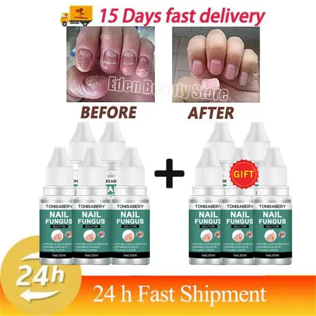Nail Fungus Treatment Serum