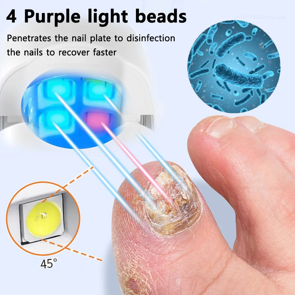 Nail Fungus Treatment Light Device