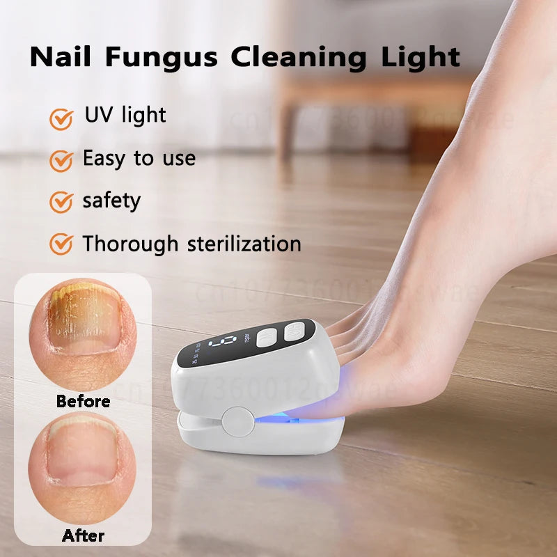 Nail Fungus Treatment Light Device