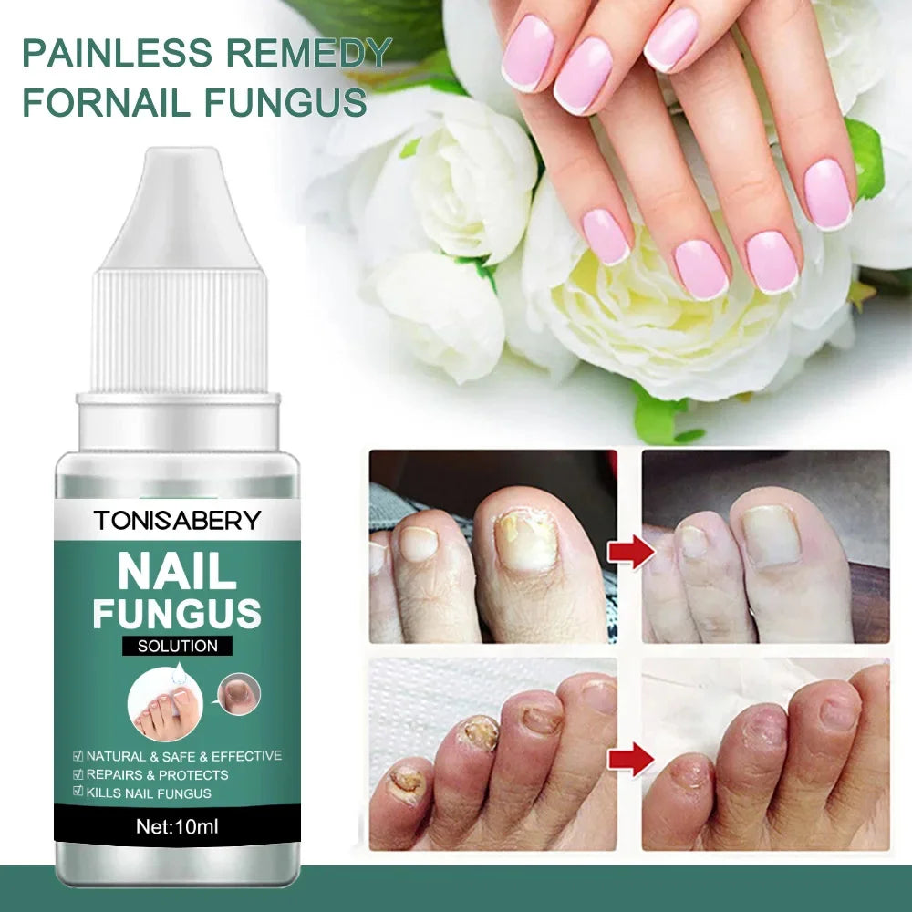 Nail Fungus Treatment Serum