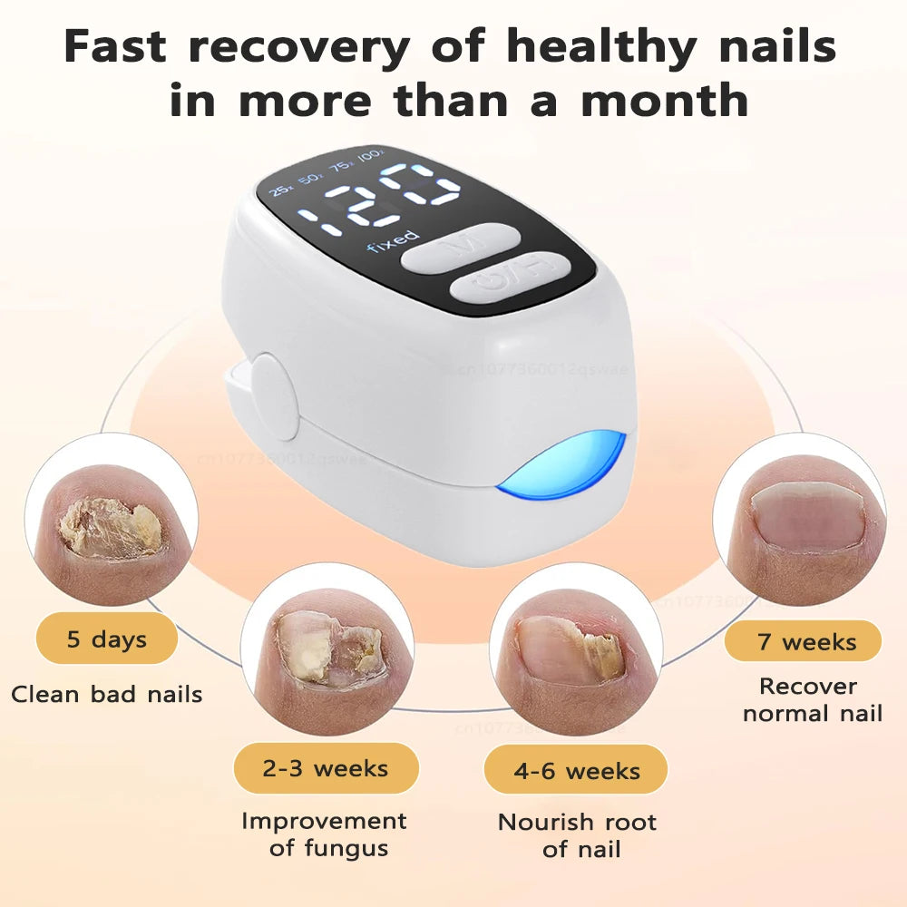 Nail Fungus Treatment Light Device
