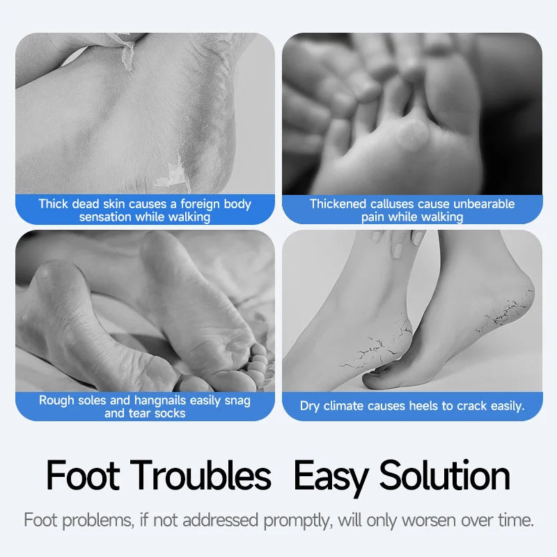 Electric Foot Grinder