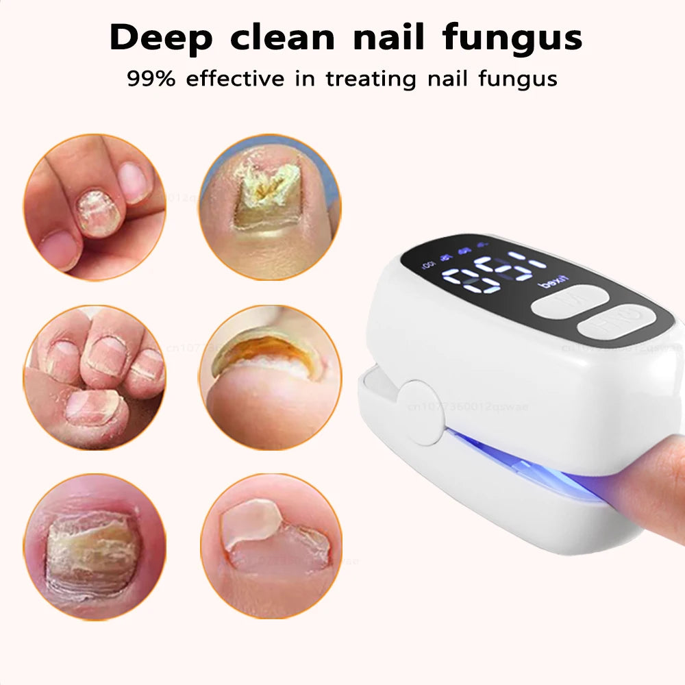 Nail Fungus Treatment Light Device