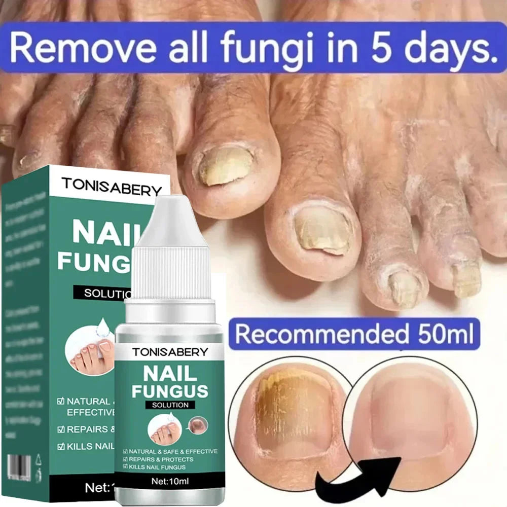 Nail Fungus Treatment Serum