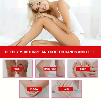 42% Urea Hand and Foot Cream