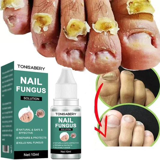 Nail Fungus Treatment Serum