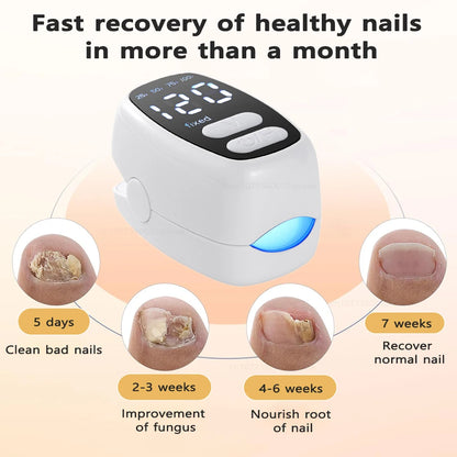 Nail Fungus Treatment Light Device