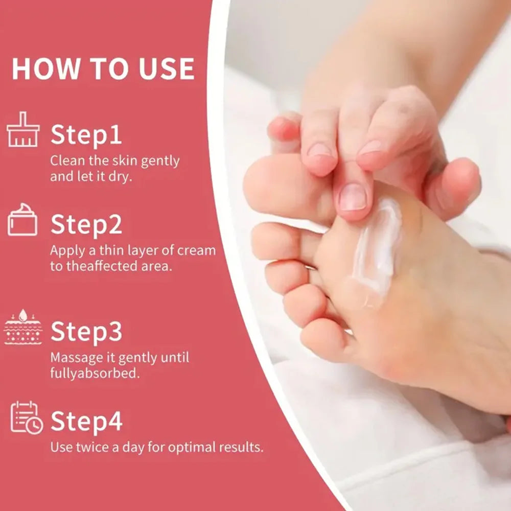42% Urea Hand and Foot Cream