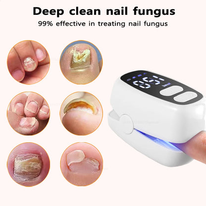 Nail Fungus Treatment Light Device